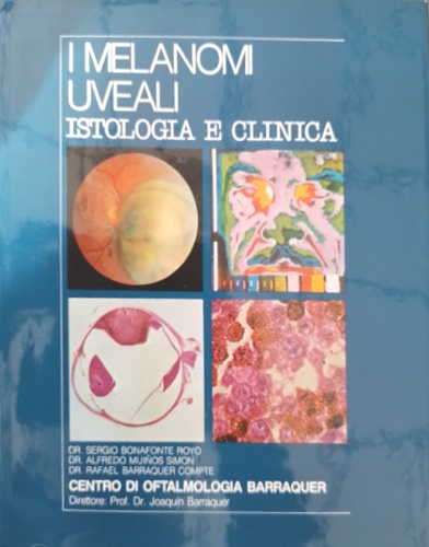 I melanomi uveali. Istologia e clinica.