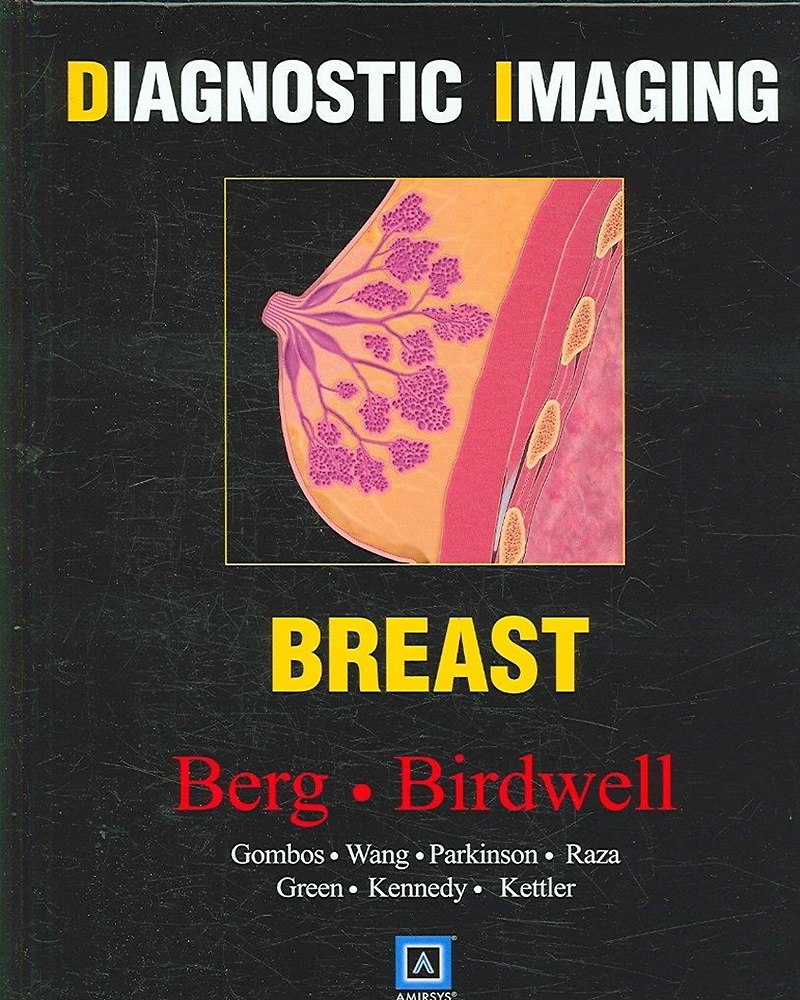 9781416033370-Diagnostic Imaging: Breast.