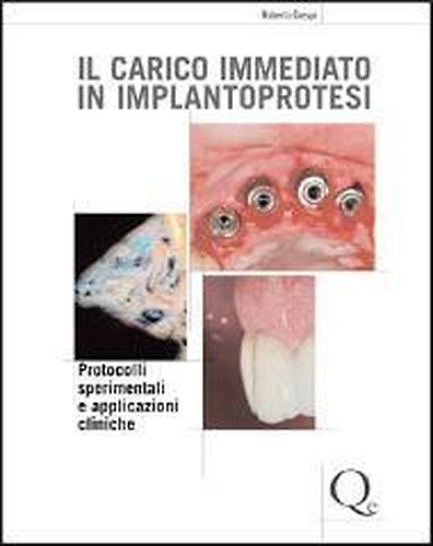 9788874921218-Il carico immediato in implantoprotesi.