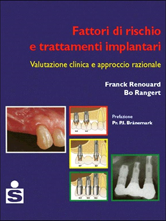Fattori di rischio e trattamenti implantari.