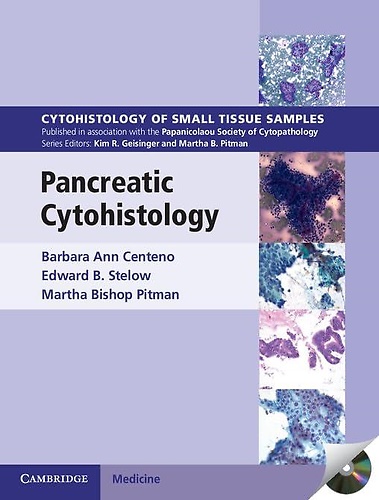 9781107518308-Pancreatic Cytohistology.