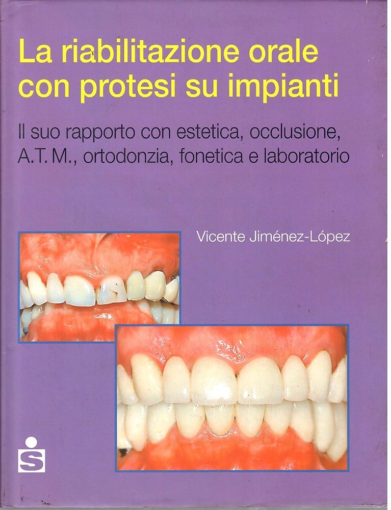 9781100002811-La riabilitazione orale con protesi su impianti.