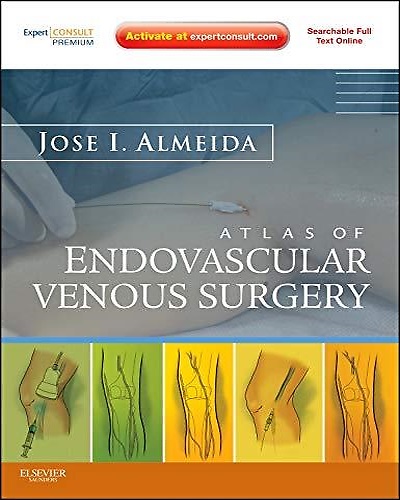 9781437717907-Atlas of Endovascular Venous Surgery: Expert Consult.